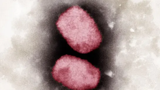 Elektronenmikroskopische Aufnahme von Affenpocken-Viren, koloriert (Bestmögliche Bildqualität). (Foto: Andrea Männel/Andrea Schnartendorff/RKI/dpa)