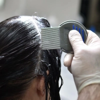 Gründliche Untersuchung ist entscheidend: Mit einem Läusekamm und einer Haarspülung lassen sich Läuse und Eier im feuchten Haar am zuverlässigsten aufspüren. (Foto: Britta Pedersen/dpa-Zentralbild/dpa-tmn)