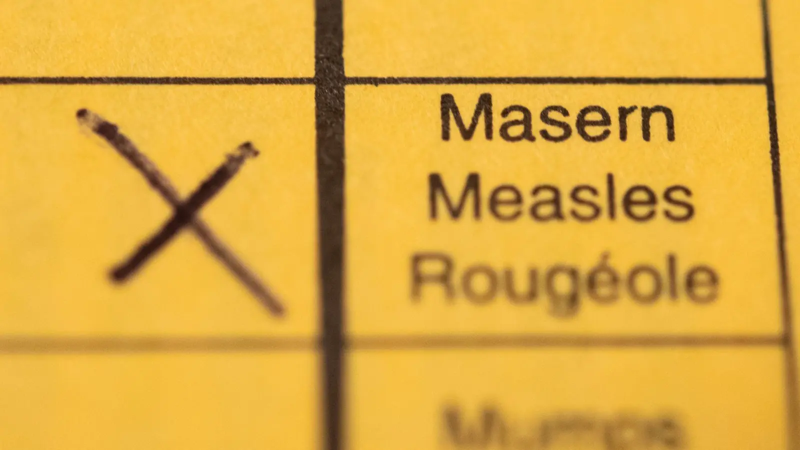 Masern können tödlich verlaufen und sind hoch ansteckend. (Symbolbild) (Foto: Tom Weller/dpa)