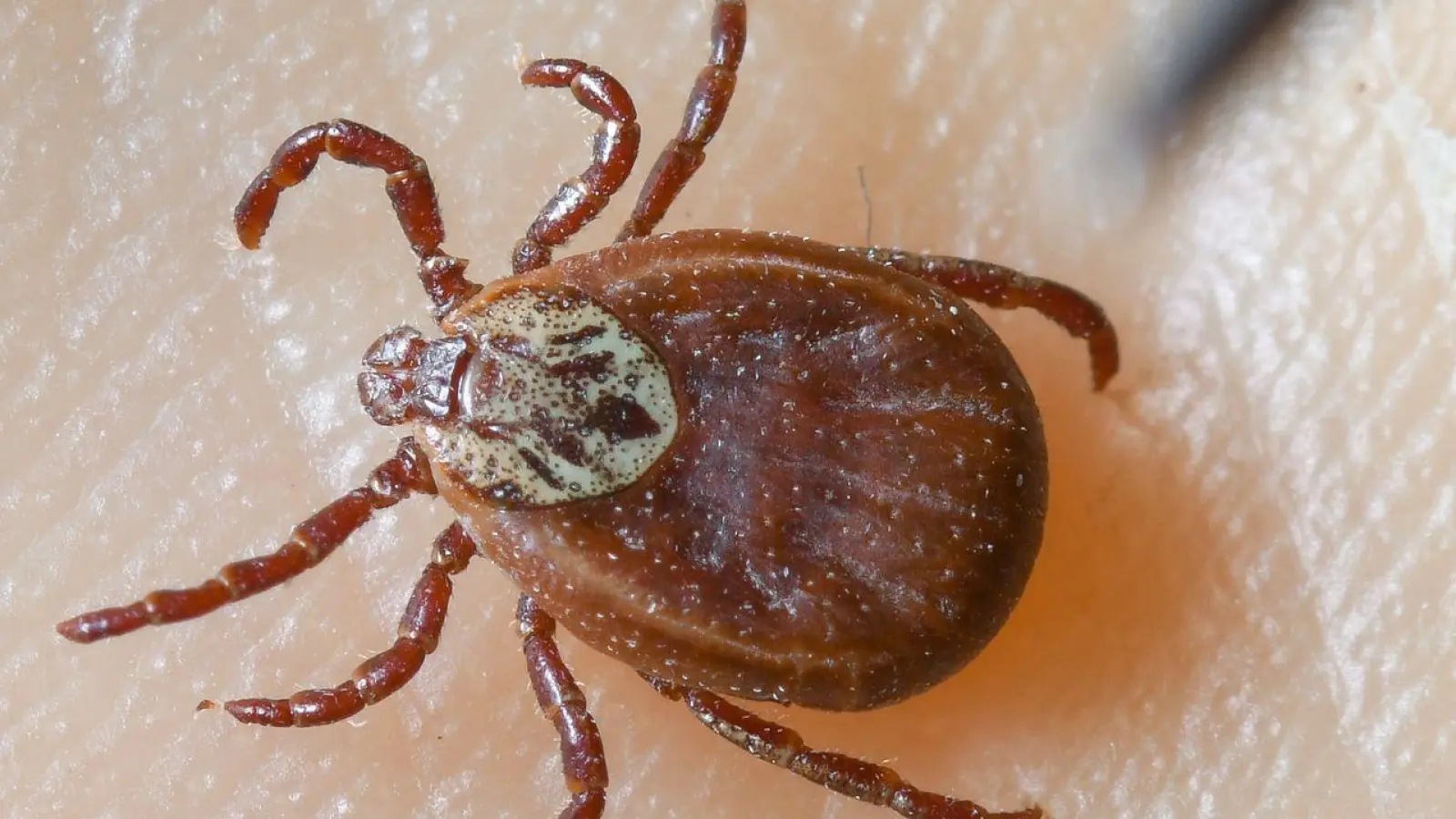 Nach Aufenthalten im Freien sollte man nach Zecken suchen. (Archivbild).  (Foto: Patrick Pleul/dpa-Zentralbild/dpa)