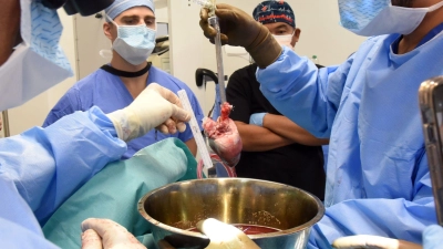 Chirurgen an der Uniklinik in Baltimore bereiten sich auf die Schweineherz-Transplantation vor. Es ist der weltweit zweite Eingriff dieser Art. (Foto: Mark Teske/University of Maryland School of Medicine/dpa)