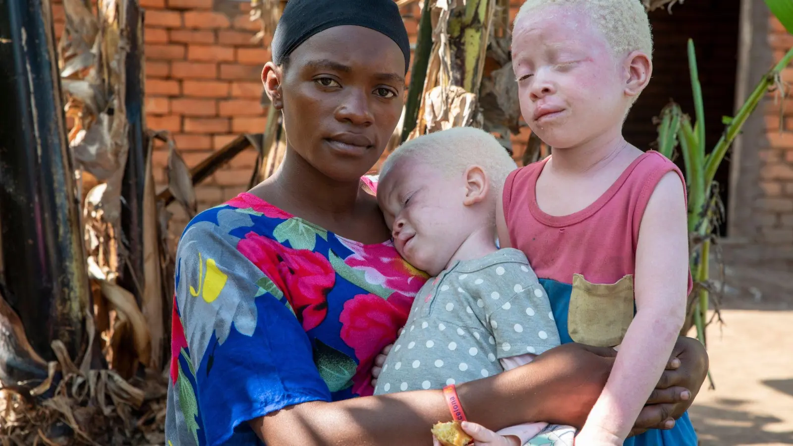 Faith (l, 22) ist die Mutter von Akram (2,5, M) und Aisha (4). Sie hat zwei Kinder mit Albinismus. (Foto: Tobias Pflanz/Christoffel Blindenmission/dpa)