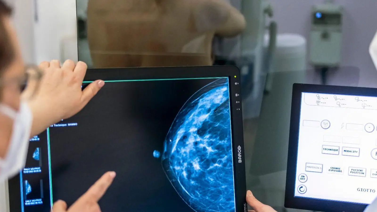 Medizinisches Personal untersucht mit einer Mammografie die Brust einer Frau auf Brustkrebs. (Foto: Hannibal Hanschke/dpa)