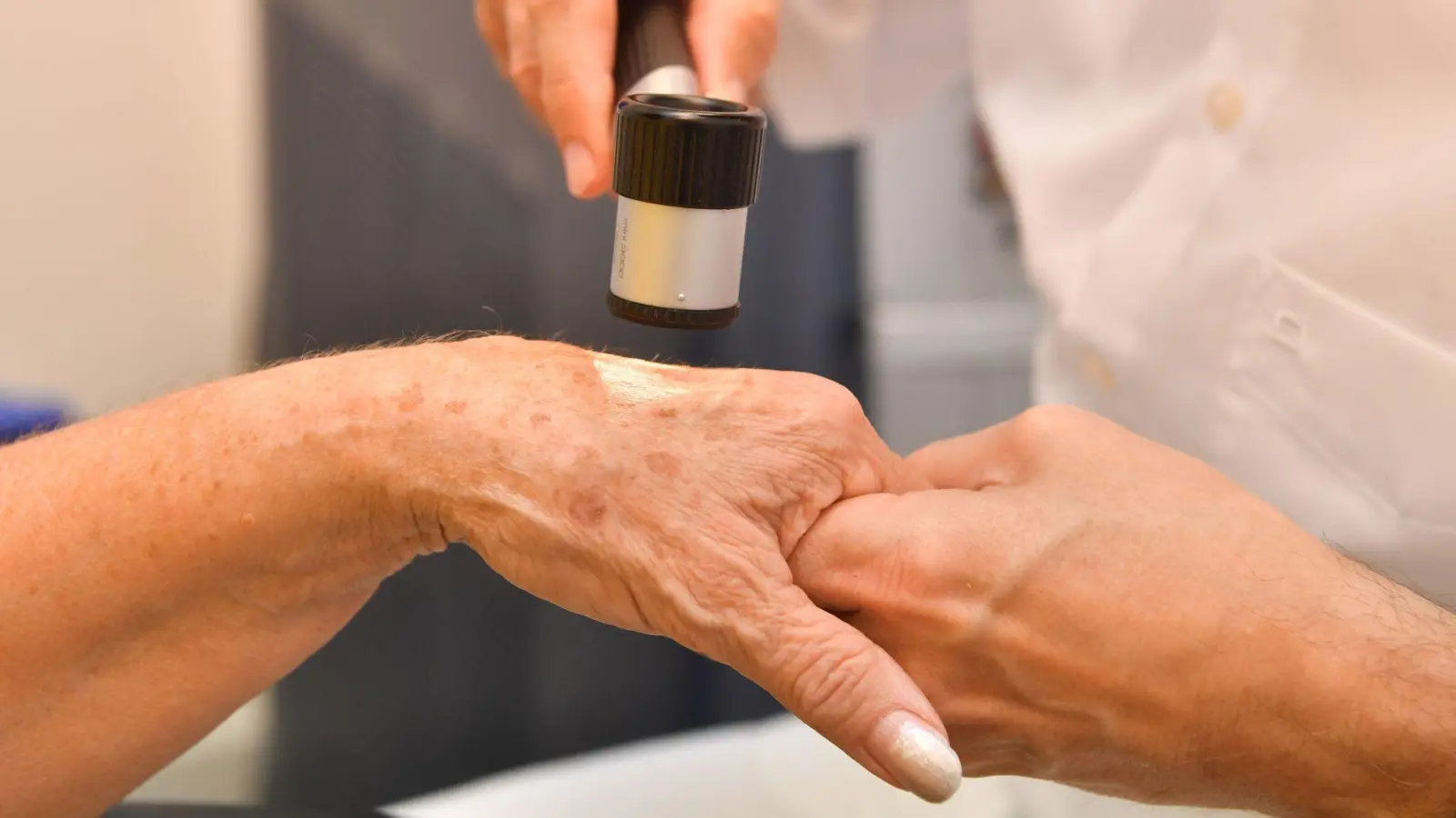 Dermatologische Praxen bieten verschiedene Methoden an, um Altersflecken dauerhaft zu entfernen. (Foto: Uli Deck/dpa-tmn)
