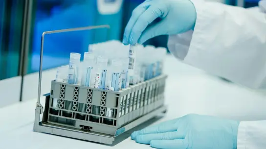 Ein Mitarbeiter hält in einem Coronatest-Labor PCR-Teströhrchen in den Händen. (Foto: Uwe Anspach/dpa)