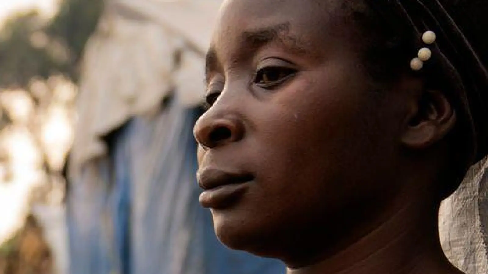 Die Erkrankung wird vor allem durch mangelnden Zugang zu sauberem Trinkwasser und sanitären Einrichtungen begünstigt. (Archivbild) (Foto: Moses Sawasawa/AP/dpa)