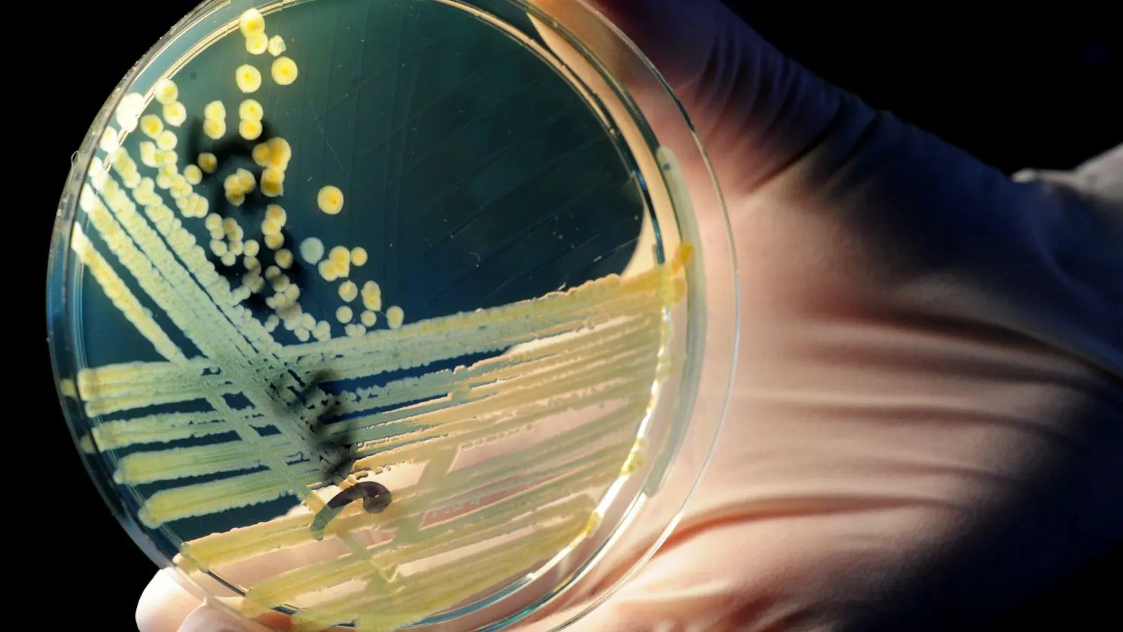 Vom Verzehr eines verunreinigten Lebensmittels bis zum Ausbruch der Erkrankung dauert es im Durchschnitt drei bis vier Tage (Archivbild) (Foto: Julian Stratenschulte/dpa)