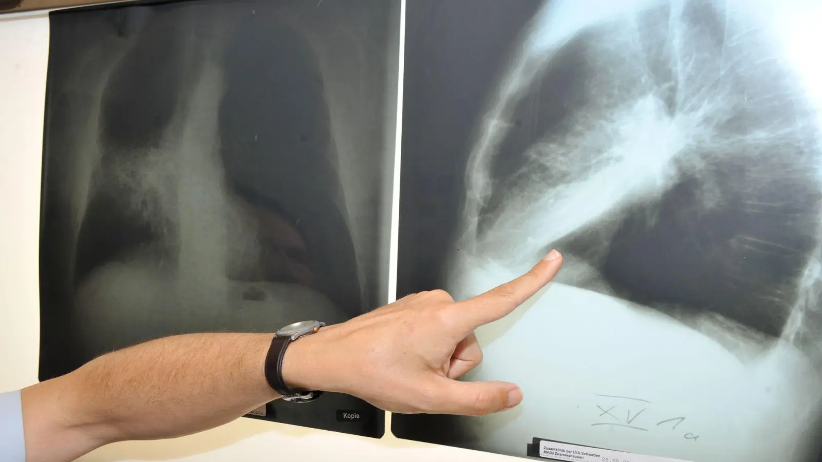 Im Winter weniger zu lüften, kann die Belastung mit krebserregendem Radon in der Wohnung erhöhen. (Archivbild) (Foto: Felix Hörhager/dpa)