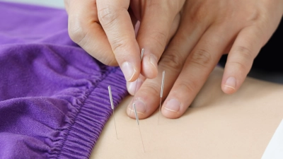 Studien haben gezeigt, dass Akupunktur bei der Behandlung verschiedener Schmerzarten wirksam sein kann. (Foto: Pixabay)