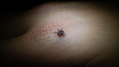 FSME und Borreliose: Diese beiden Erkrankungen können Zecken übertragen, wenn sie selbst mit den Erregern infiziert sind.  (Foto: Marijan Murat/dpa/dpa-tmn)