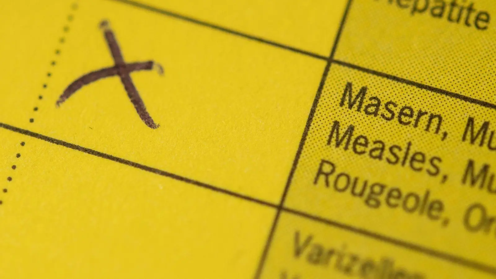 In Bayern wurden 2025 weniger Masern-Infektionen als 2024 registriert. (Symbolbild) (Foto: Marius Becker/dpa)